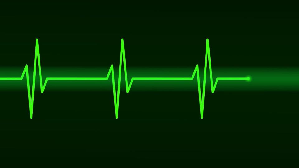 Electrocardiograma
